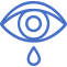 Conjunctivitis