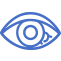 Keratitis