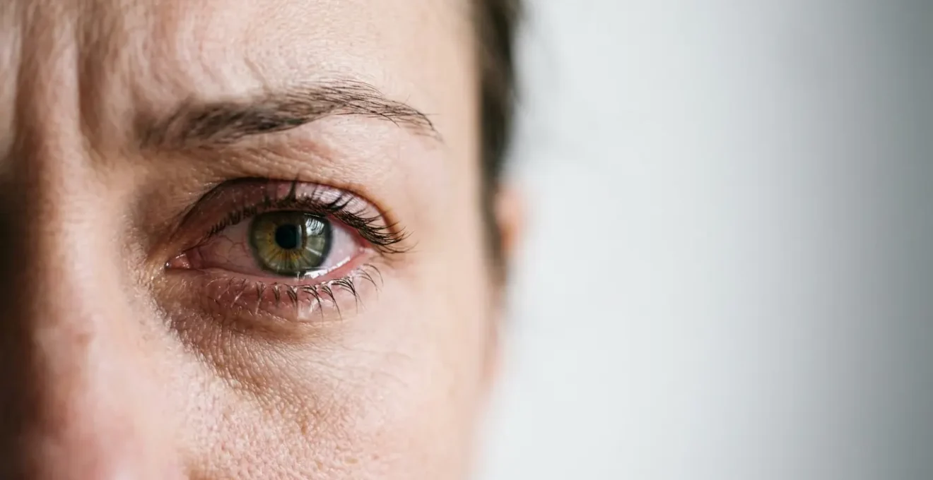 Extreme close-up of a human eye showing medical distress and pain intensity