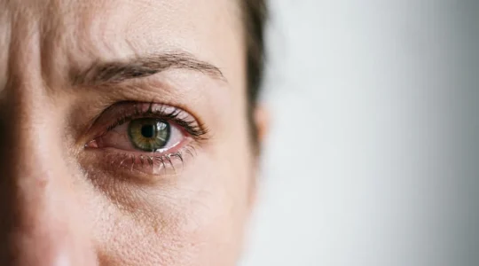 Extreme close-up of a human eye showing medical distress and pain intensity