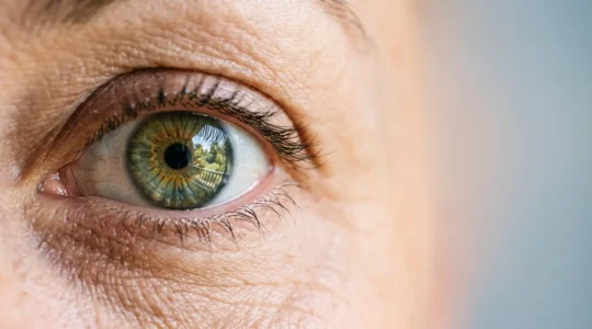 Close-up view of a human eye with subtle reflection showing clarity and focus, representing vision correction through modern lens replacement surgery
